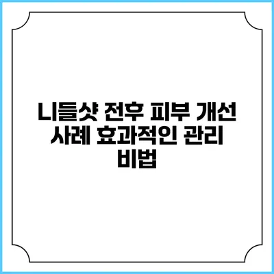 니들샷 전후 피부 개선 사례: 효과적인 관리 비법